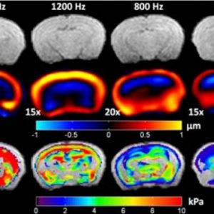Frequency Dependence of Mouse Brain Tissue Stiffness Measured in vivo with MR Elastography