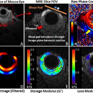 Non-invasive Measurement of Vitreous Humor Stiffness in the Mouse using MR Elastography